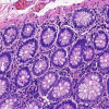 HEMATOXYLIN G1