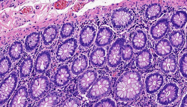 HEMATOXYLIN G1