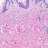 Hematoxylin G3