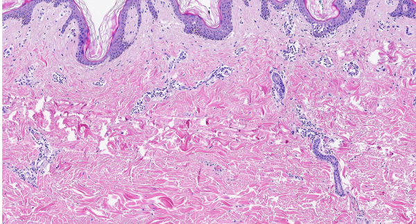 Hematoxylin G3