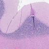 HEMATOXYLIN H