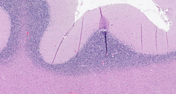 HEMATOXYLIN H