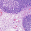 HEMATOXYLIN H