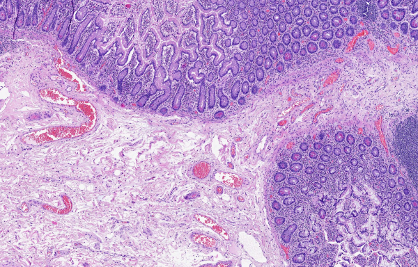 HEMATOXYLIN H