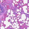 HEMATOXYLIN H
