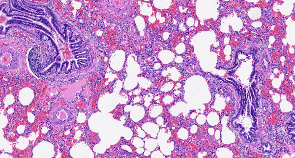 HEMATOXYLIN H