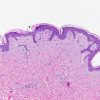 HEMATOXYLIN H
