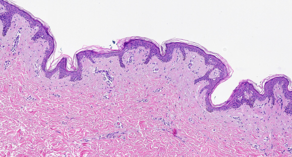 HEMATOXYLIN H