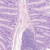 HEMATOXYLIN ML