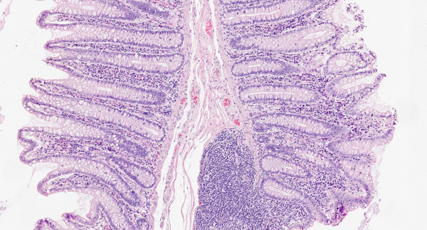 HEMATOXYLIN ML