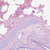 HEMATOXYLIN ML