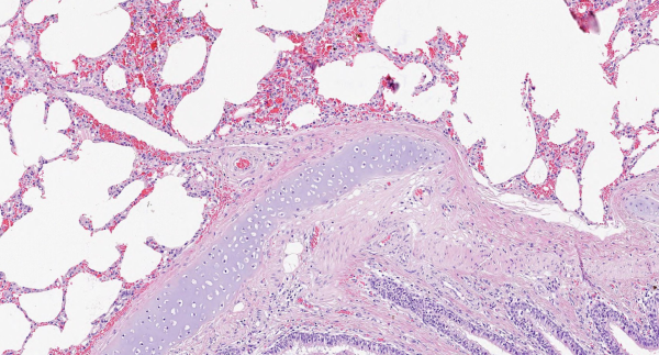 HEMATOXYLIN ML