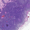 HEMATOXYLIN ML