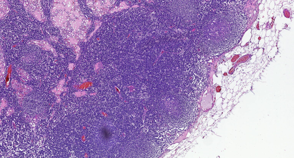 HEMATOXYLIN ML